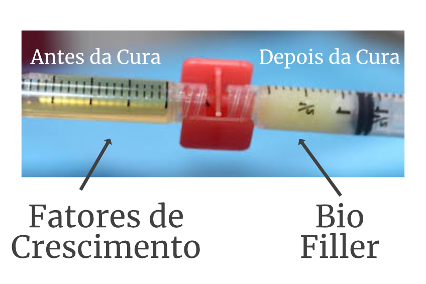 Bio Filler - Dra. Débora Genovese